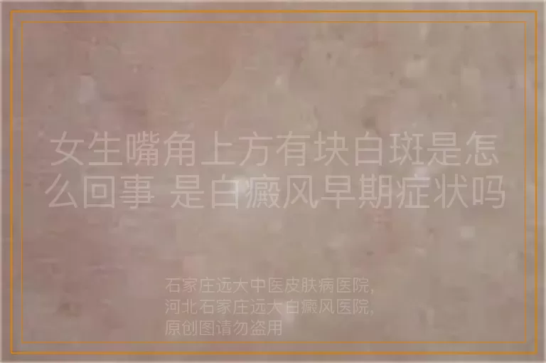 女生嘴角上方有块白斑是怎么回事 是白癜风早期症状吗