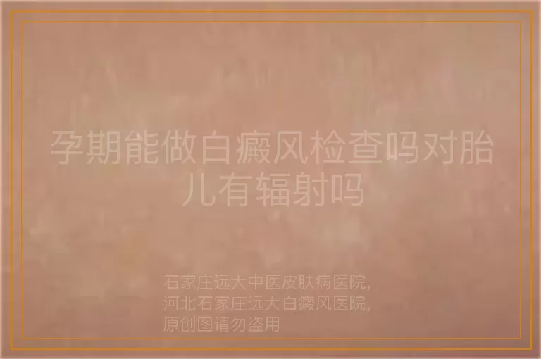 孕期能做白癜风检查吗对胎儿有辐射吗
