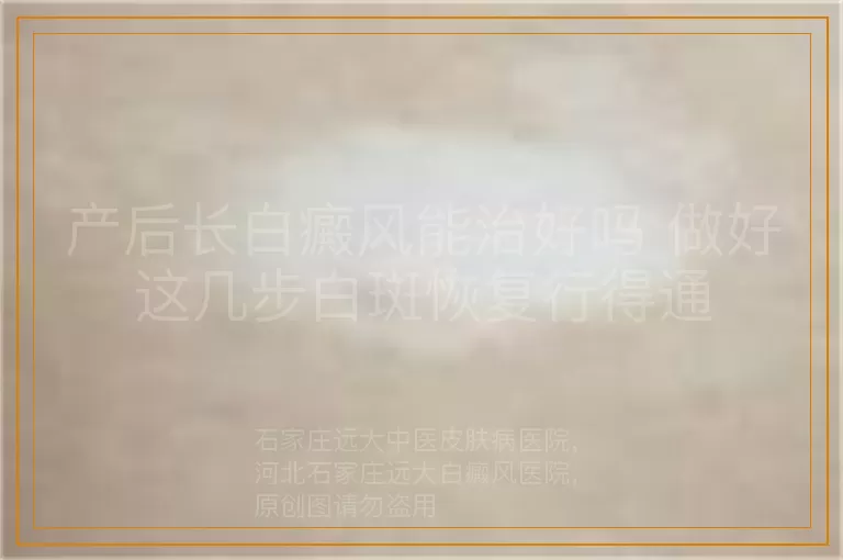 产后长白癜风能治好吗 做好这几步白斑恢复行得通