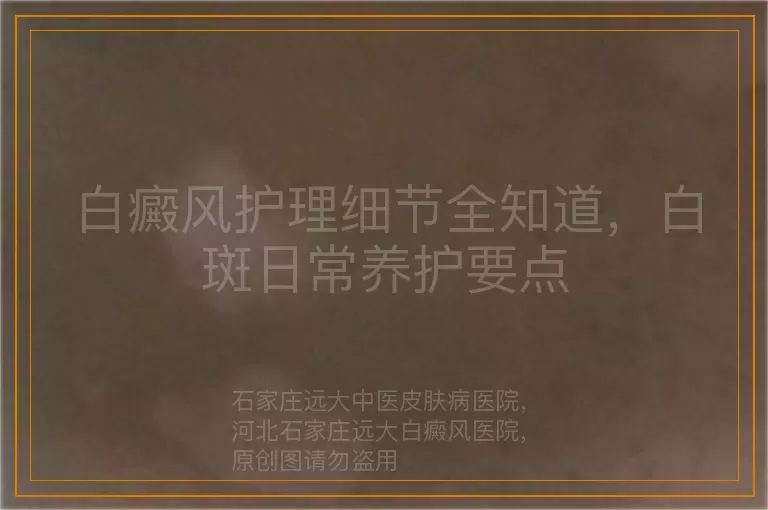 白癜风护理细节全知道，白斑日常养护要点
