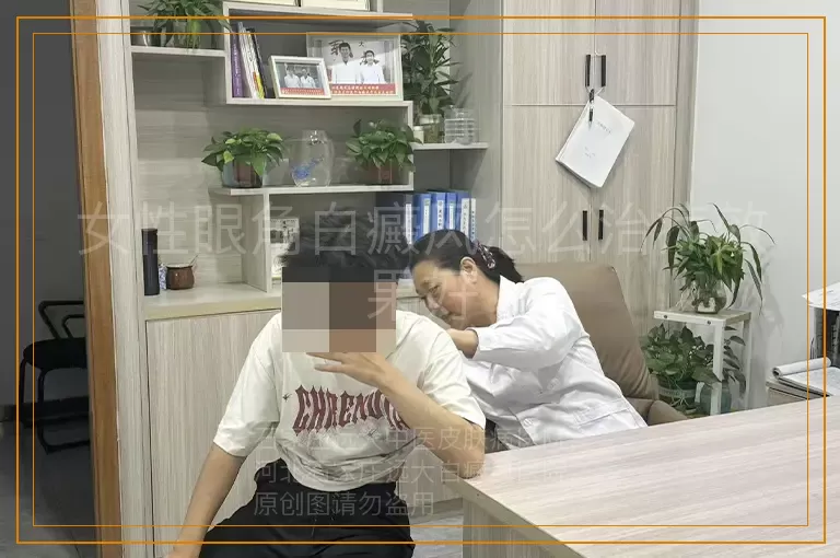女性眼角白癜风怎么治疗效果好