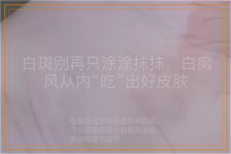 白斑别再只涂涂抹抹，白癜风从内“吃”出好皮肤