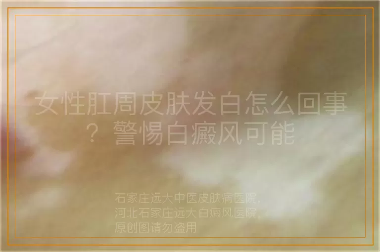 女性肛周皮肤发白怎么回事？警惕白癜风可能