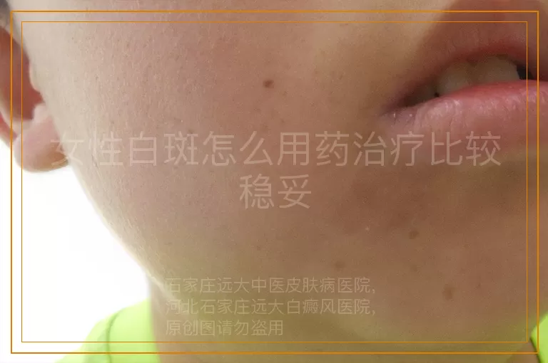 女性白斑怎么用药治疗比较稳妥