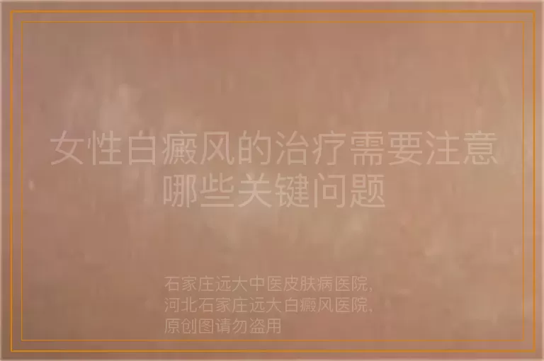 女性白癜风的治疗需要注意哪些关键问题