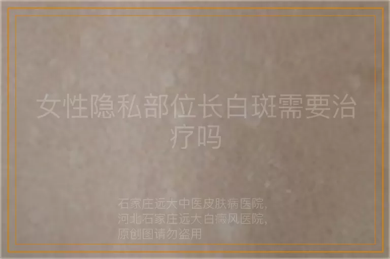 女性隐私部位长白斑需要治疗吗