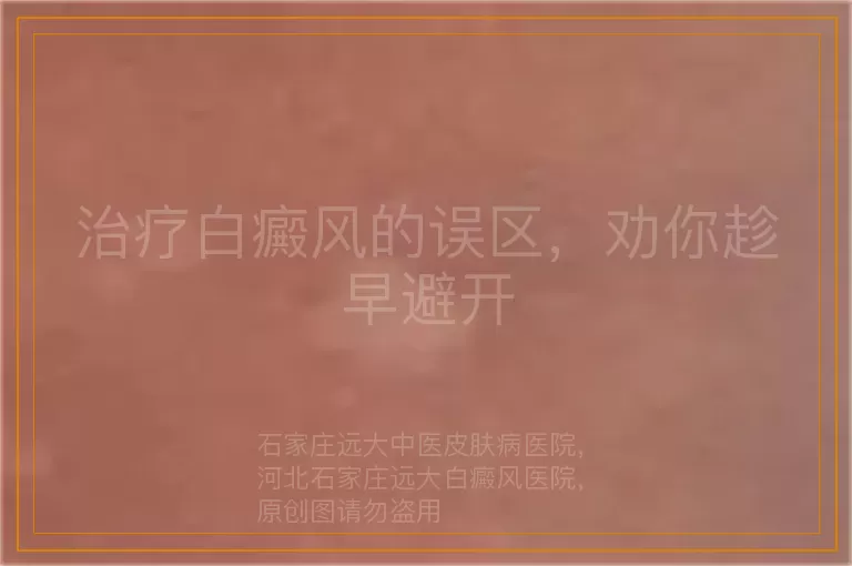 治疗白癜风的误区，劝你趁早避开