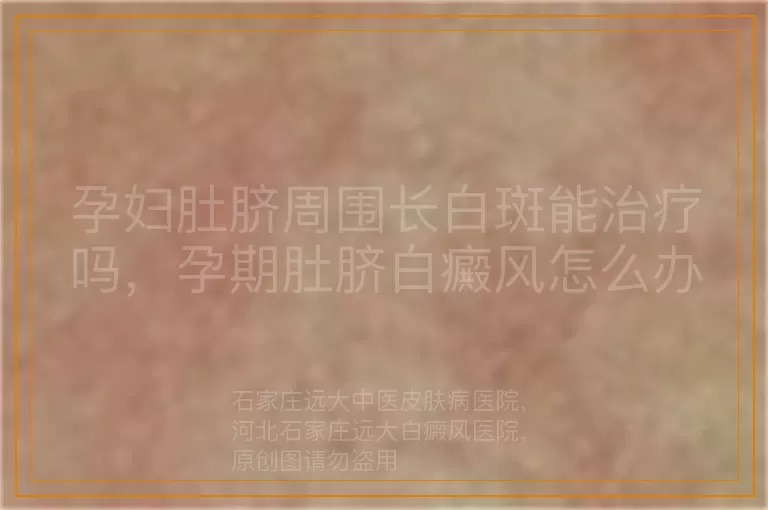 孕妇肚脐周围长白斑能治疗吗，孕期肚脐白癜风怎么办，孕妇身上有白癜风怎么处理