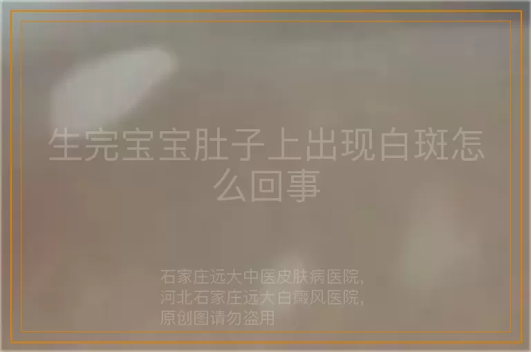生完宝宝肚子上出现白斑怎么回事