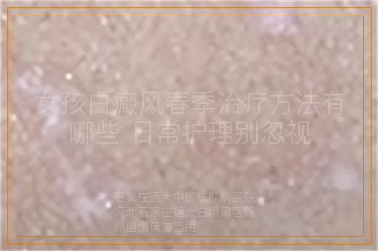 女孩白癜风春季治疗方法有哪些 日常护理别忽视