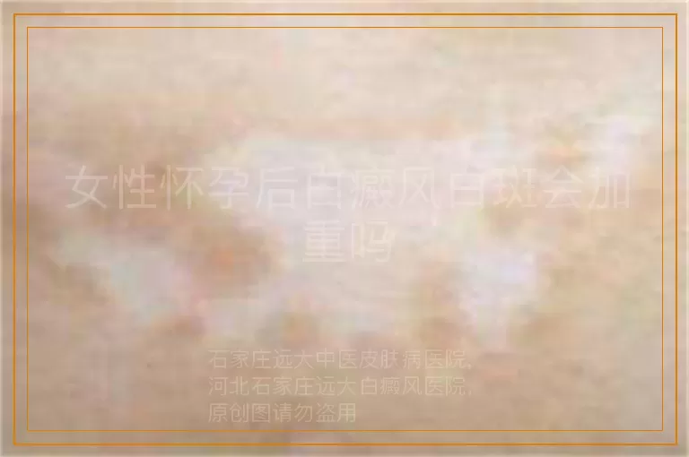 女性怀孕后白癜风白斑会加重吗