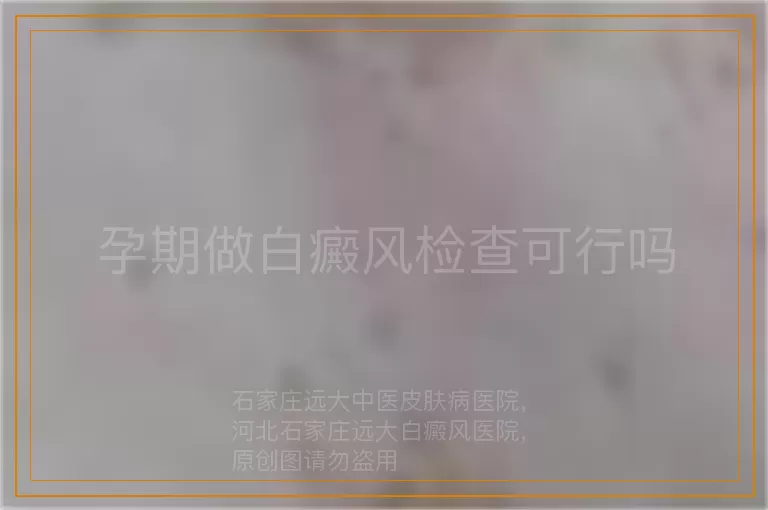 孕期做白癜风检查可行吗
