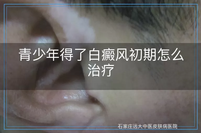 青少年得了白癜风初期怎么治疗