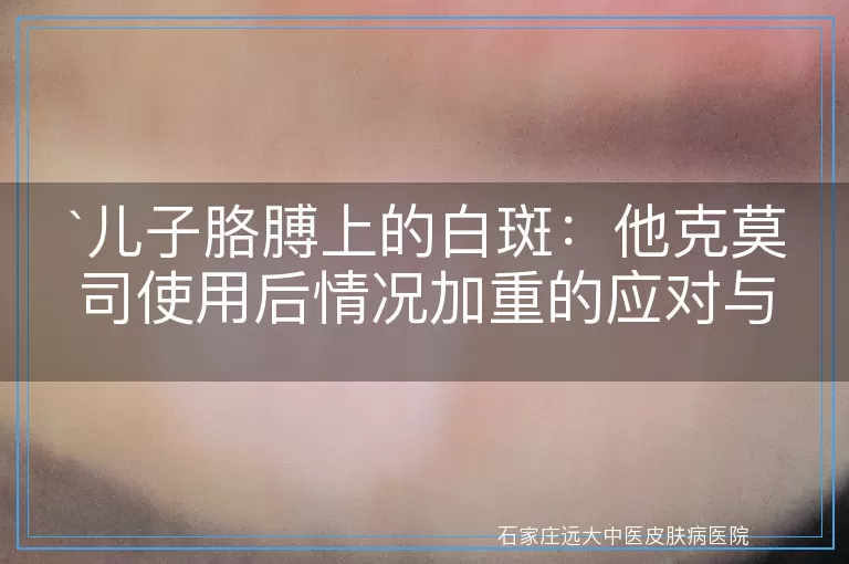儿子胳膊上的白斑：他克莫司使用后情况加重的应对与解析