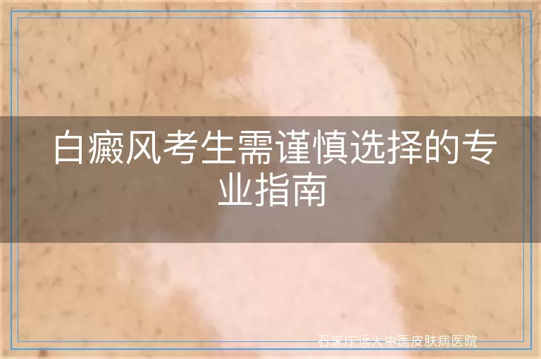 白癜风考生需谨慎选择的专业指南