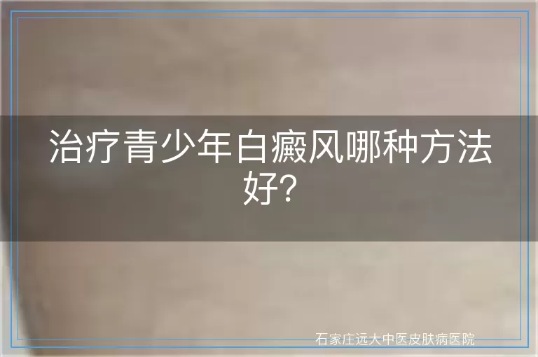 治疗青少年白癜风哪种方法好？
