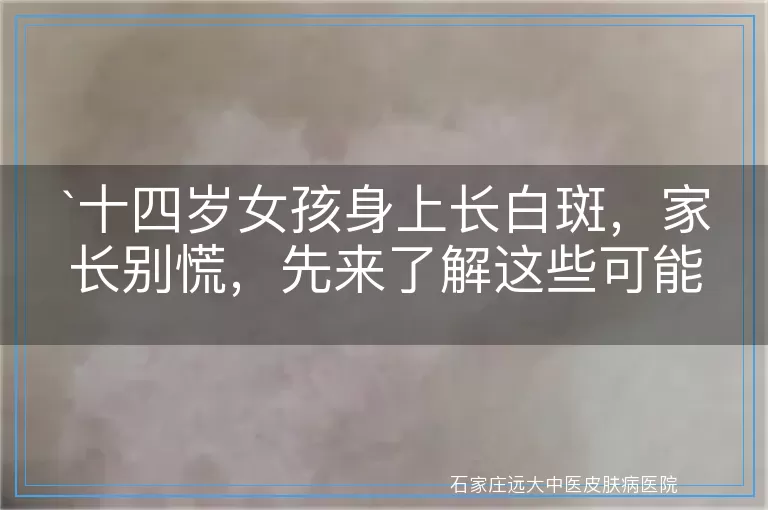 十四岁女孩身上长白斑，家长别慌，先来了解这些可能的原因