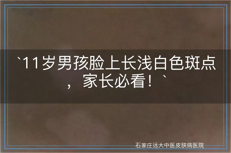 11岁男孩脸上长浅白色斑点，家长必看！