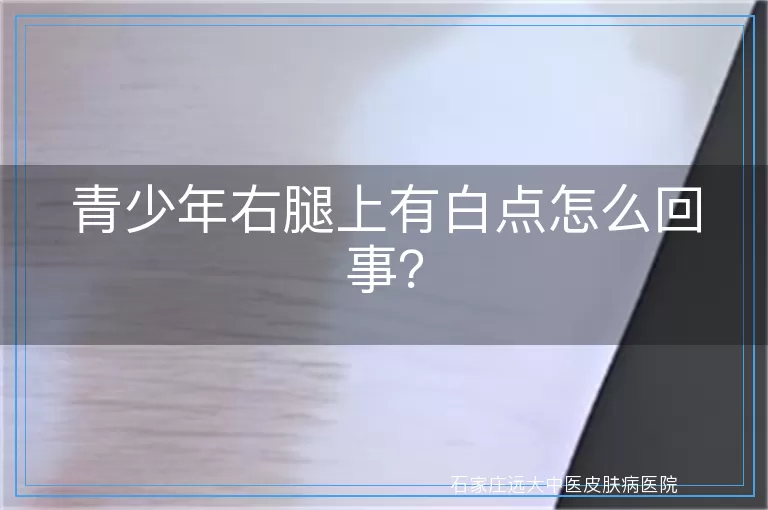 青少年右腿上有白点怎么回事？