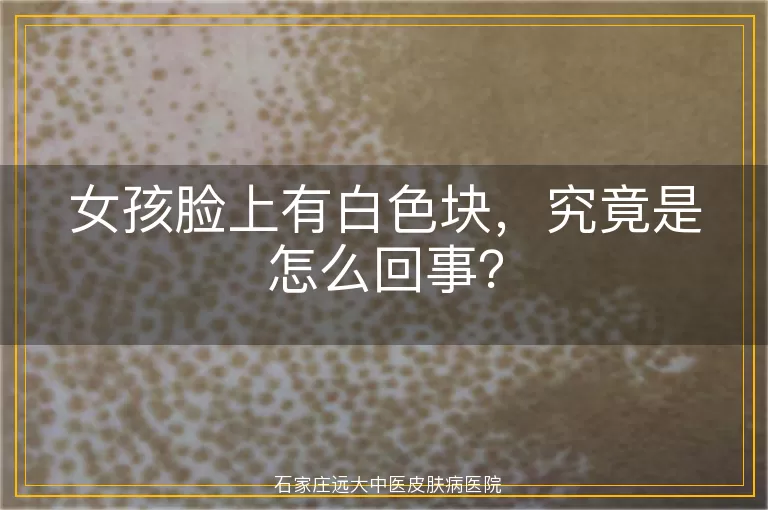 女孩脸上有白色块，究竟是怎么回事？
