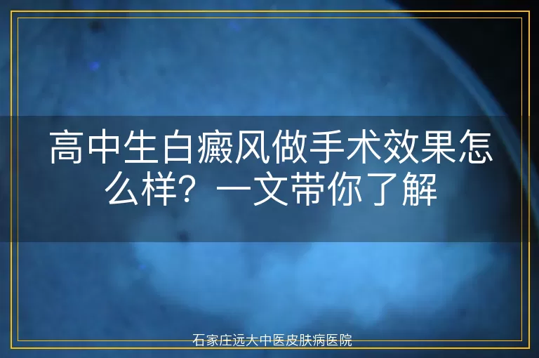 高中生白癜风做手术效果怎么样？一文带你了解