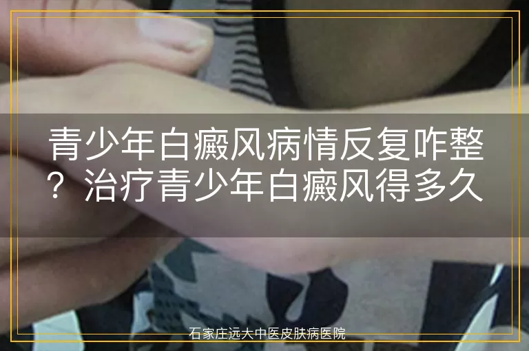 青少年白癜风病情反复咋整？治疗青少年白癜风得多久？