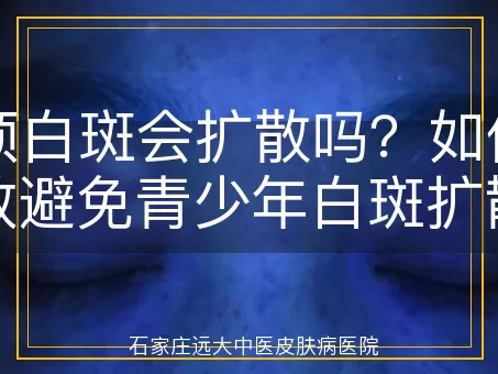 头顶白斑会扩散吗？如何有效避免青少年白斑扩散