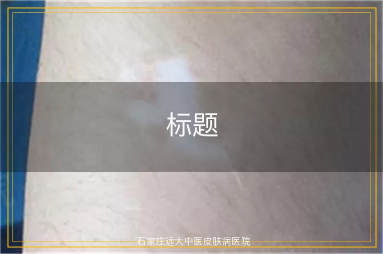 标题