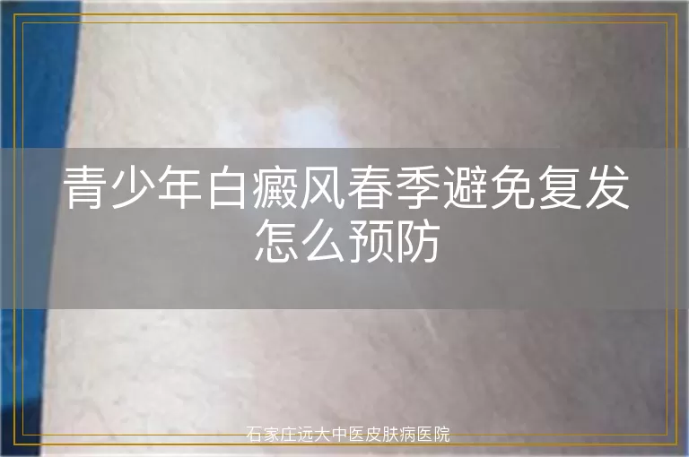 青少年白癜风春季避免复发怎么预防