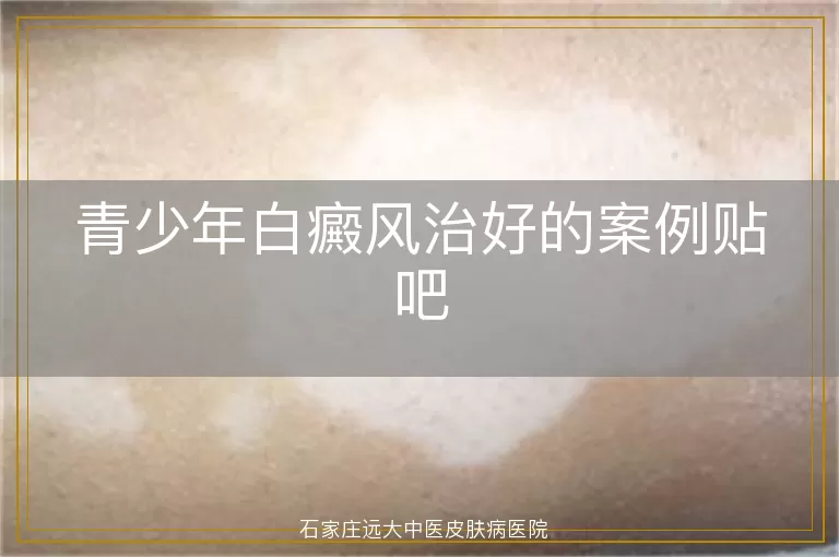 青少年白癜风治好的案例贴吧