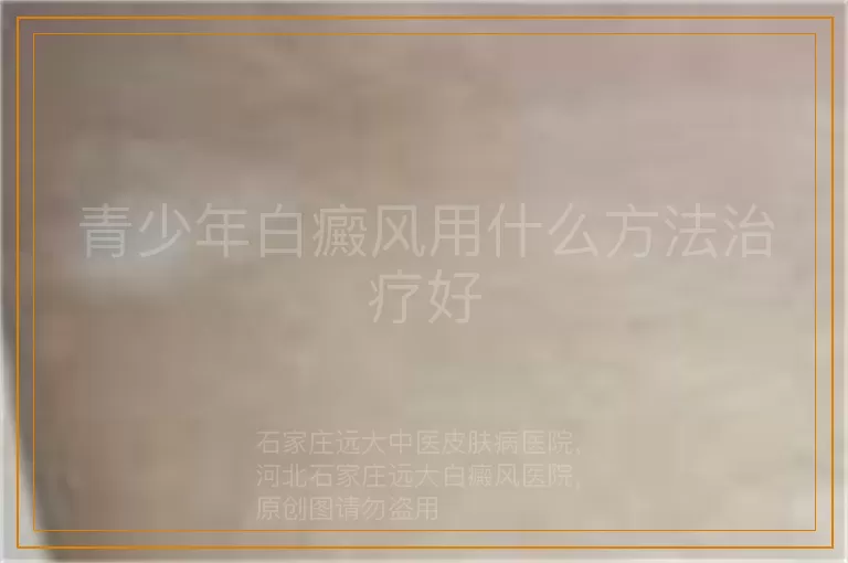 青少年白癜风用什么方法治疗好