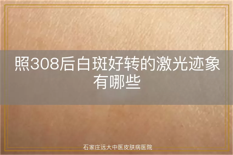 照308后白斑好转的激光迹象有哪些