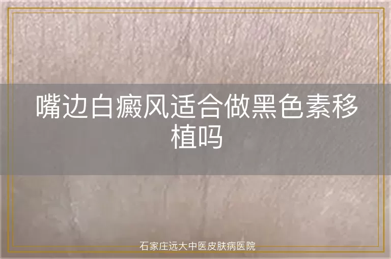 嘴边白癜风适合做黑色素移植吗
