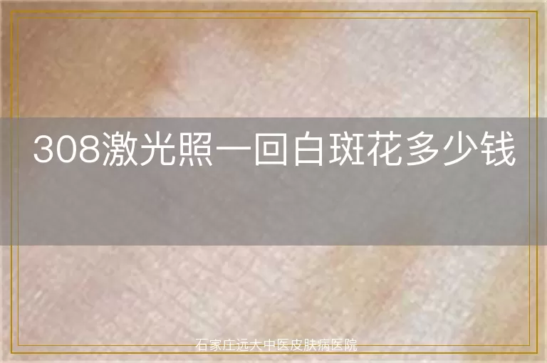 308激光照一回白斑花多少钱