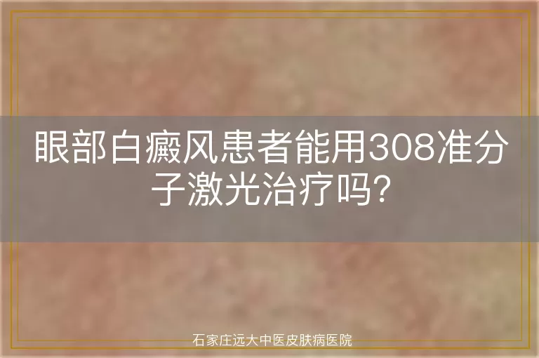 眼部白癜风患者能用308准分子激光治疗吗？