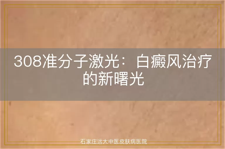 308准分子激光：白癜风治疗的新曙光