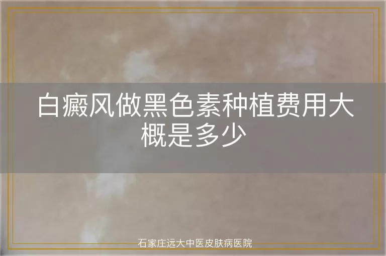 白癜风做黑色素种植费用大概是多少