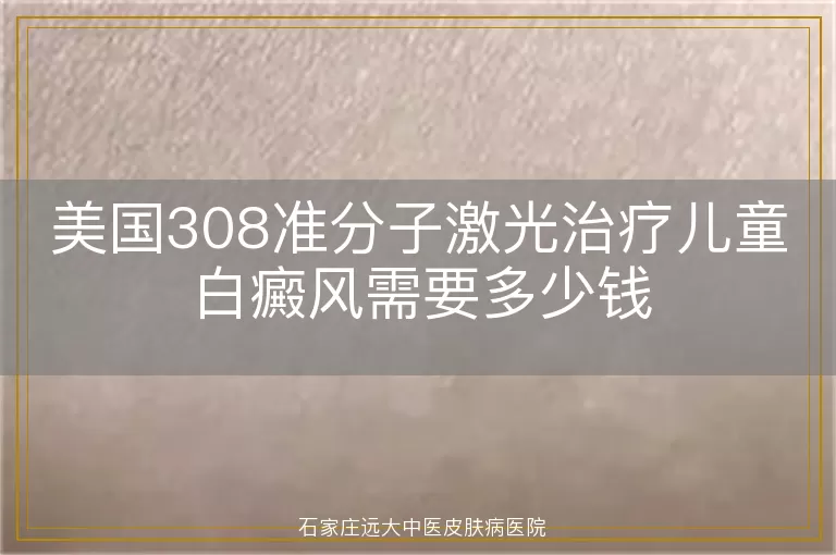 美国308准分子激光治疗儿童白癜风需要多少钱