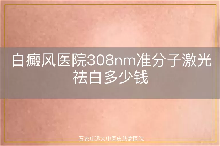白癜风医院308nm准分子激光祛白多少钱