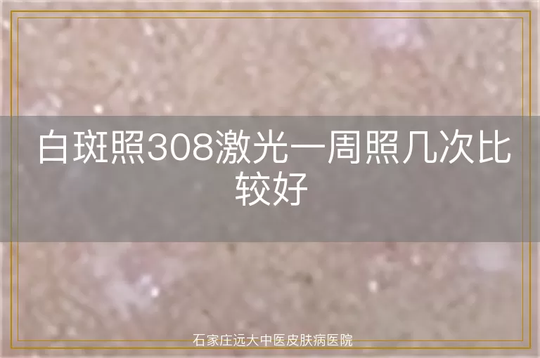 白斑照308激光一周照几次比较好