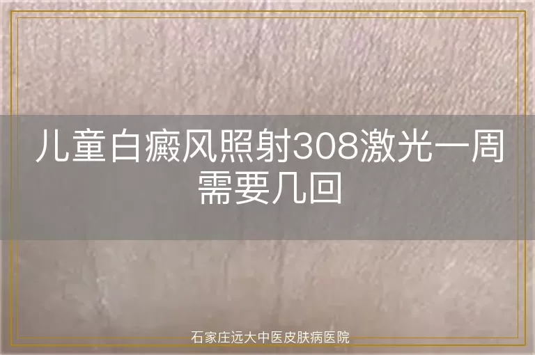 儿童白癜风照射308激光一周需要几回