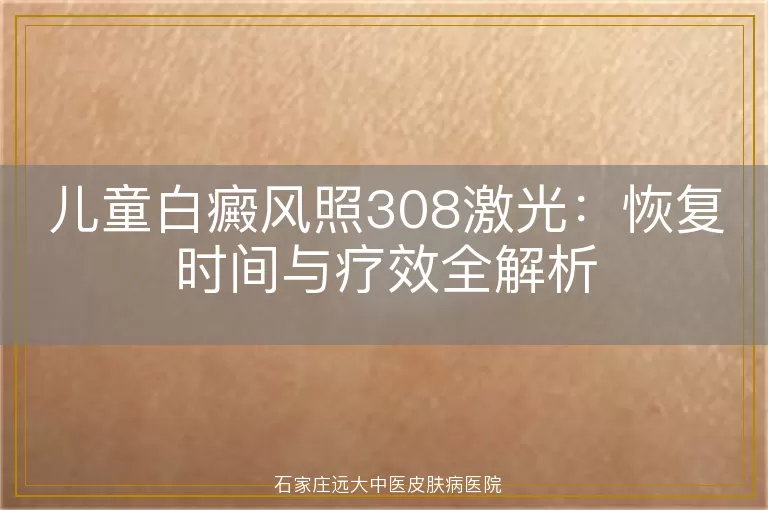 儿童白癜风照308激光：恢复时间与疗效全解析
