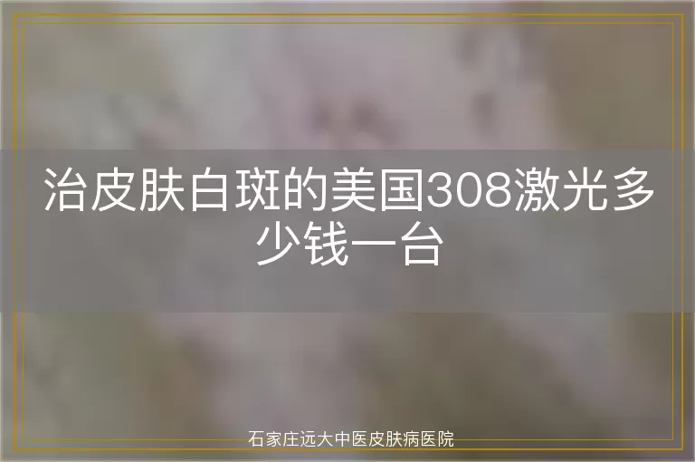 治皮肤白斑的美国308激光多少钱一台