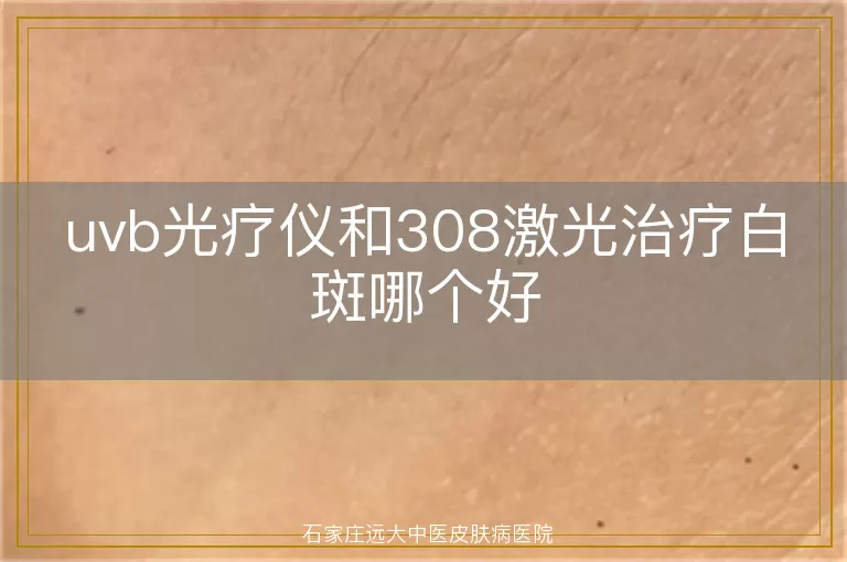 uvb光疗仪和308激光治疗白斑哪个好