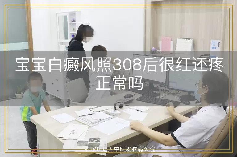 宝宝白癜风照308后很红还疼正常吗