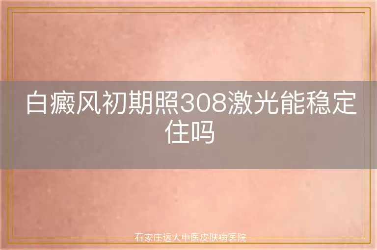 白癜风初期照308激光能稳定住吗
