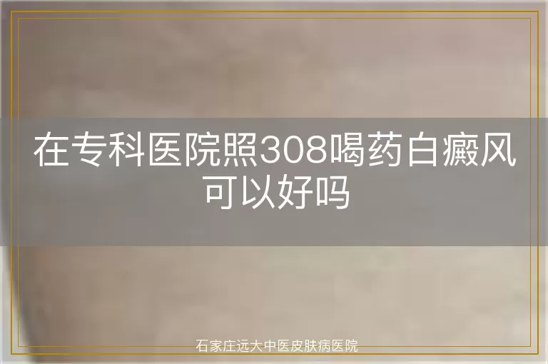 在专科医院照308喝药白癜风可以好吗