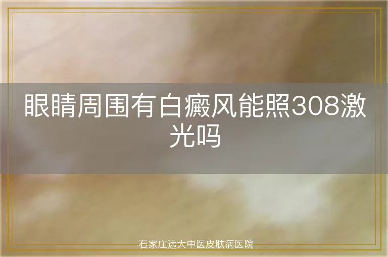 眼睛周围有白癜风能照308激光吗