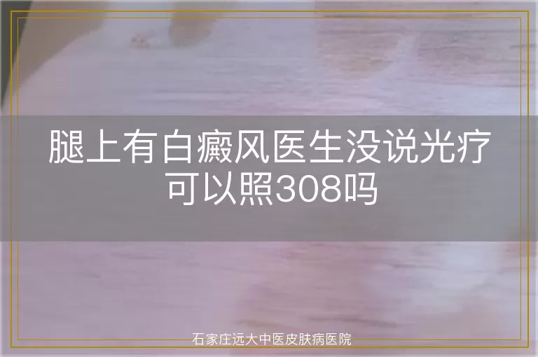 腿上有白癜风医生没说光疗可以照308吗