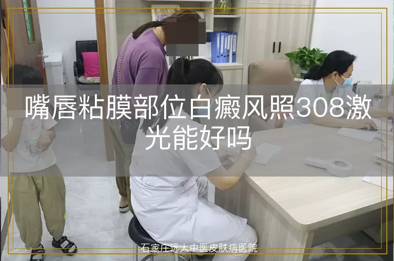 嘴唇粘膜部位白癜风照308激光能好吗